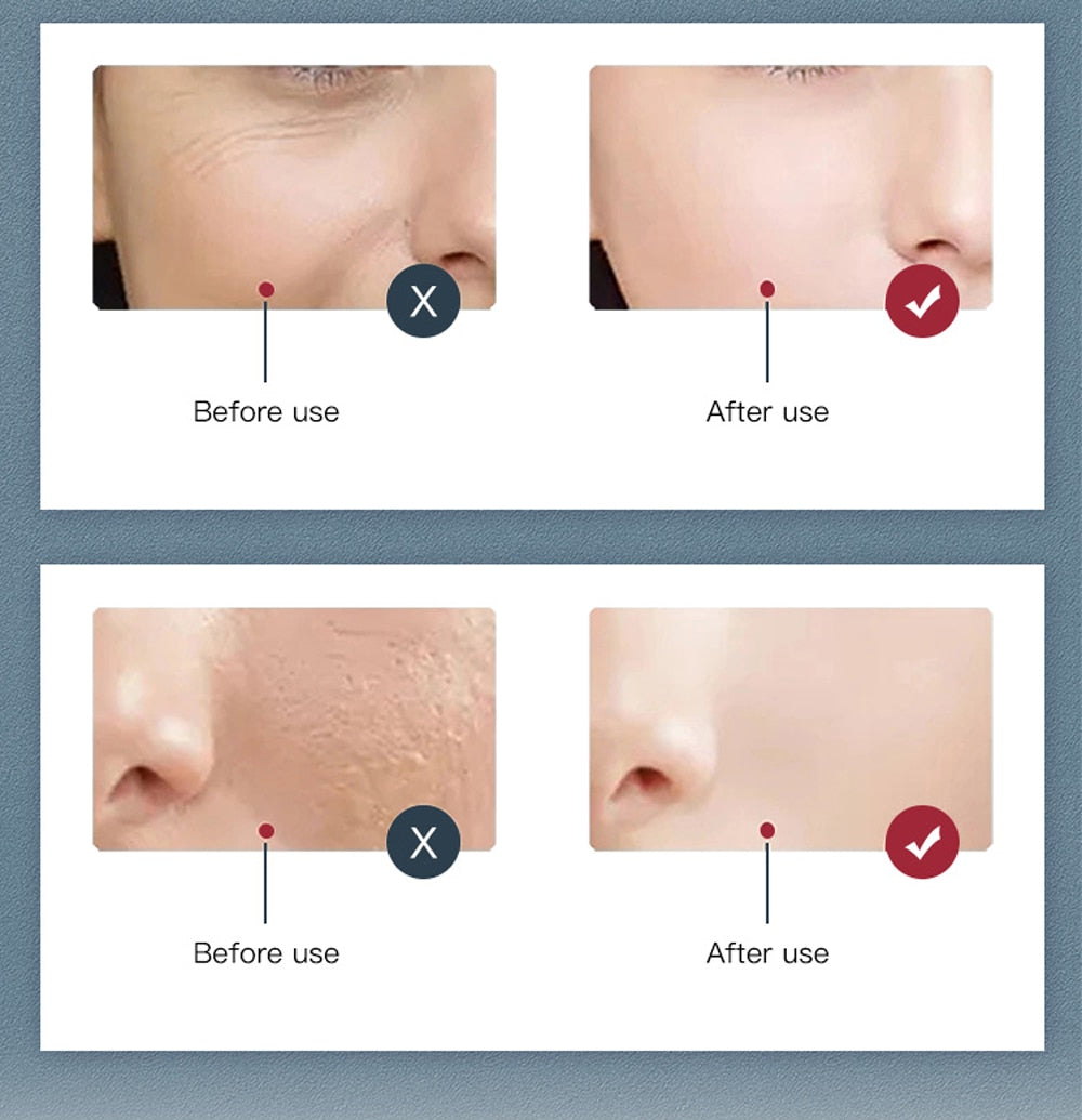 Home1992™ 7 Colors LED Facial Mask PDT Light Therapy